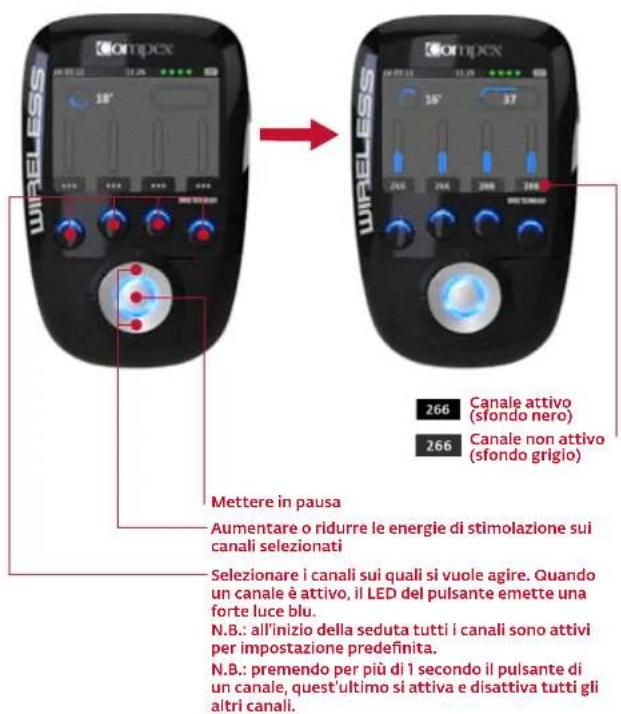 COMPEX Wireless - INIZIO DELLA SEDUTA DI STIMOLAZIONE: MISURAZIONE MI-SCAN - 3