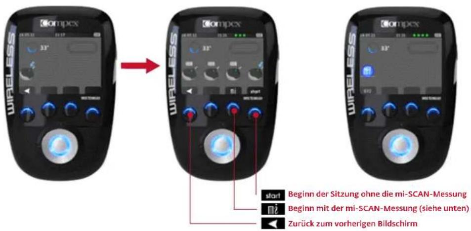 COMPEX Wireless - BEGINN DER STIMULATIONSSITZUNG: MI-SCAN-MESSUNG - 1