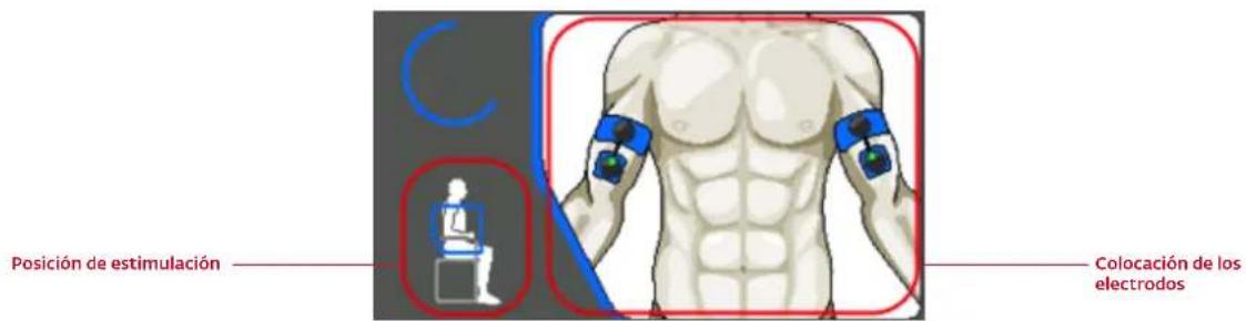 COMPEX Wireless - COLOCACIÓN DE LOS ELECTRODOS - 1