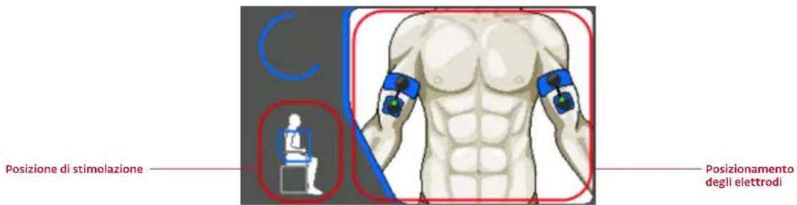 COMPEX Wireless - POSIZIONAMENTO DEGLI ELETTRODI - 1