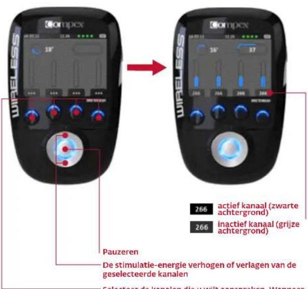COMPEX Wireless - START VAN DE STIMULATIESESSIE: MI-SCAN-METING - 2