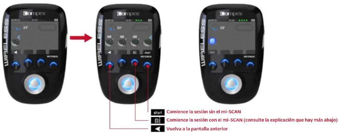 COMPEX Wireless - COMIENZO DE LA SESIÓN DE ESTIMULACIÓN: MI-SCAN - 1