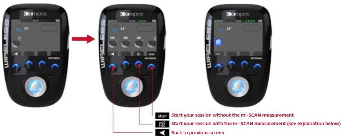 COMPEX Wireless - BEGINNING OF THE STIMULATION SESSION: MI-SCAN MEASUREMENT - 1