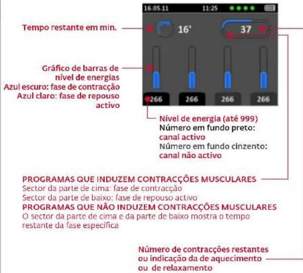 COMPEX Wireless - INÍCIO DA SESSÃO ESTIMULAÇÃO: MEDIÇÃO MI-SCAN - 2