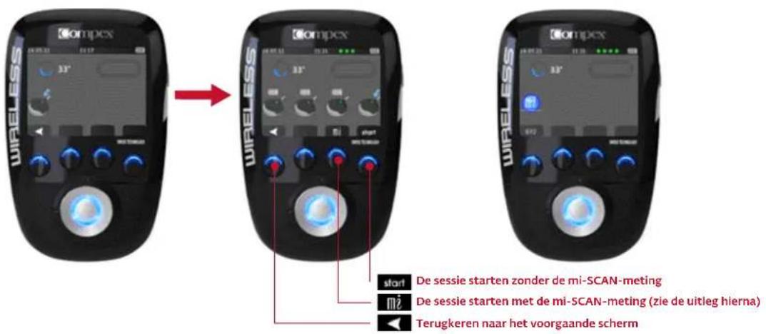 COMPEX Wireless - START VAN DE STIMULATIESESSIE: MI-SCAN-METING - 1