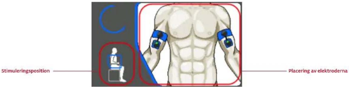 COMPEX Wireless - PLACERING AV ELEKTRODERNA - 1