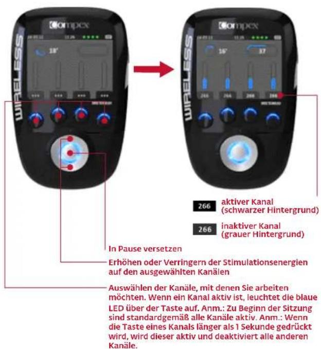 COMPEX Wireless - BEGINN DER STIMULATIONSSITZUNG: MI-SCAN-MESSUNG - 3