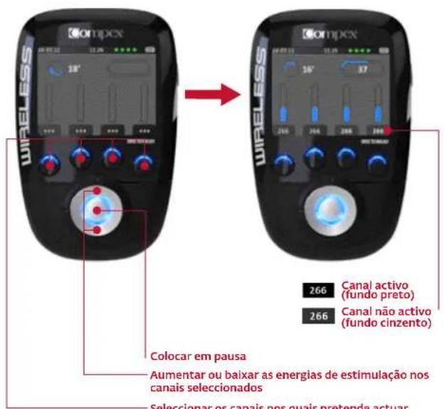 COMPEX Wireless - INÍCIO DA SESSÃO ESTIMULAÇÃO: MEDIÇÃO MI-SCAN - 3