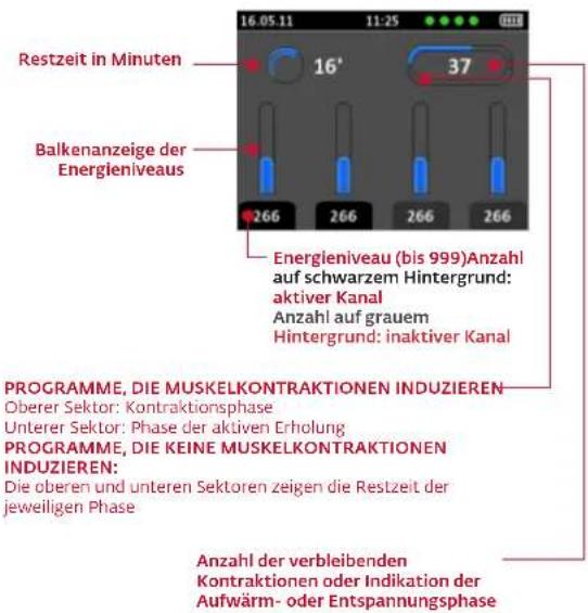 COMPEX Wireless - BEGINN DER STIMULATIONSSITZUNG: MI-SCAN-MESSUNG - 2