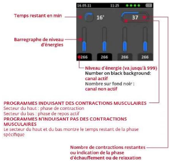 COMPEX Wireless - DÉBUT DE LA SÉANCE DE STIMULATION : MESURE MI-SCAN - 2