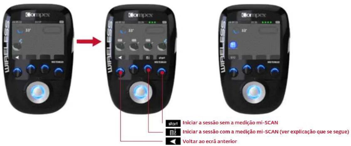 COMPEX Wireless - INÍCIO DA SESSÃO ESTIMULAÇÃO: MEDIÇÃO MI-SCAN - 1