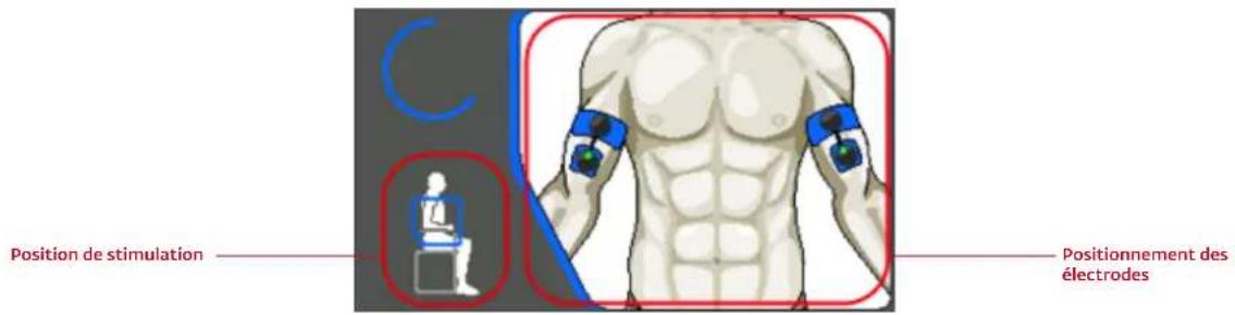 COMPEX Wireless - POSITIONNEMENT DES ÉLECTRODES - 1