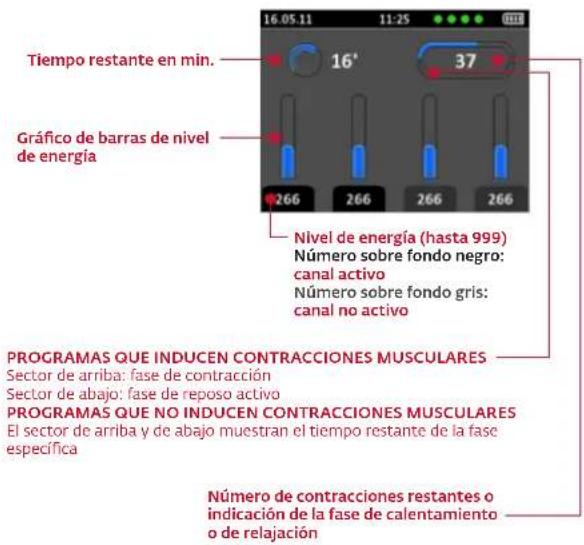 COMPEX Wireless - COMIENZO DE LA SESIÓN DE ESTIMULACIÓN: MI-SCAN - 2