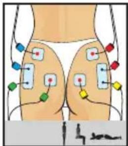 COMPEX One - Shape your buttocks - 1
