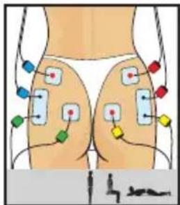 COMPEX One - Modele os seus glúteos - 1
