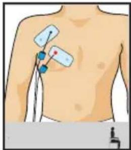 COMPEX One - Build your pecs - 1