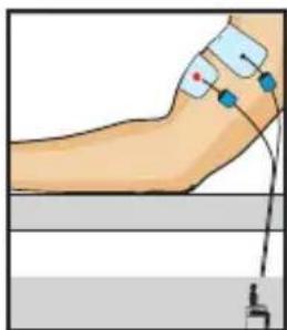 COMPEX One - Voor een 6 pack - 2