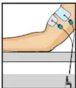 COMPEX One - Desarrolla tus bíceps - 1