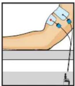 COMPEX One - Braccia - 1