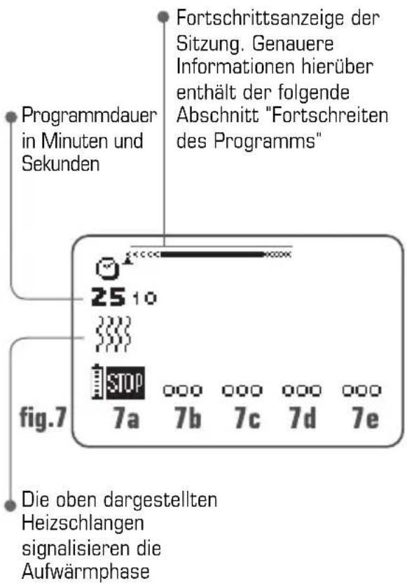 COMPEX Performance - Einstellung der Stimulationsenergie - 1
