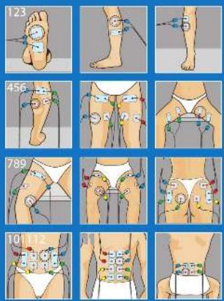 COMPEX Performance - 1