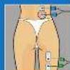 COMPEX Performance - 10