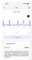 WITHINGS ScanWatch Nova - ECG Outputs - 10