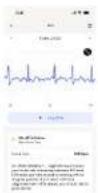 WITHINGS ScanWatch Nova - ECG Outputs - 12