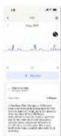 WITHINGS ScanWatch Nova - ECG Outputs - 8