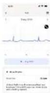 WITHINGS ScanWatch Nova - Wie man Withings ScanWatch NOVA benutzt - 9