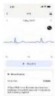 WITHINGS ScanWatch Nova - ECG Outputs - 6