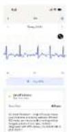 WITHINGS ScanWatch Nova - Wie man Withings ScanWatch NOVA benutzt - 15