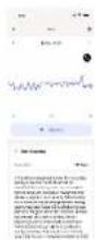 WITHINGS ScanWatch Nova - Wie man Withings ScanWatch NOVA benutzt - 19