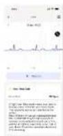 WITHINGS ScanWatch Nova - Wie man Withings ScanWatch NOVA benutzt - 7