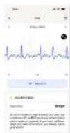 WITHINGS ScanWatch Nova - Wie man Withings ScanWatch NOVA benutzt - 13