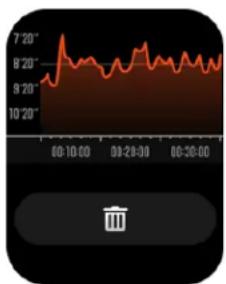 TIMEX Metropolitan S - Activities Review - 2