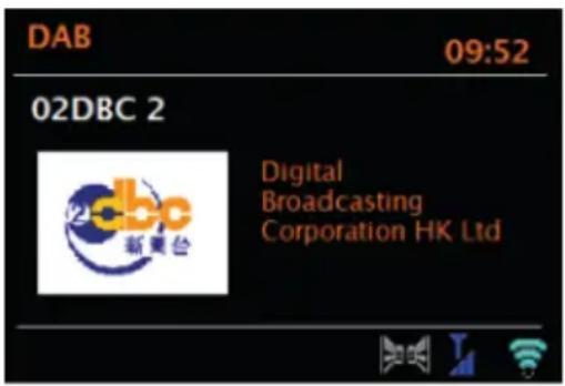 Auna Two 2.1 - RADIO DAB (OPZIONALE) - 1