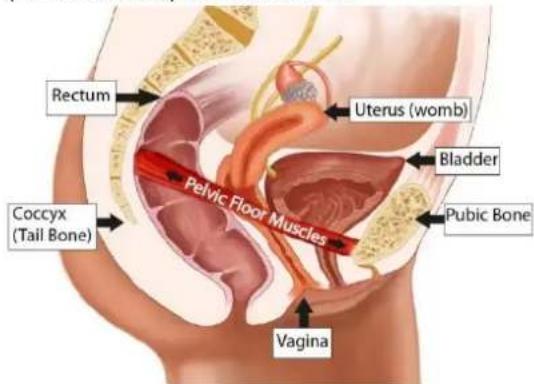 TensCare Elise 2 - PELVIC FLOOR MUSCLES - 1
