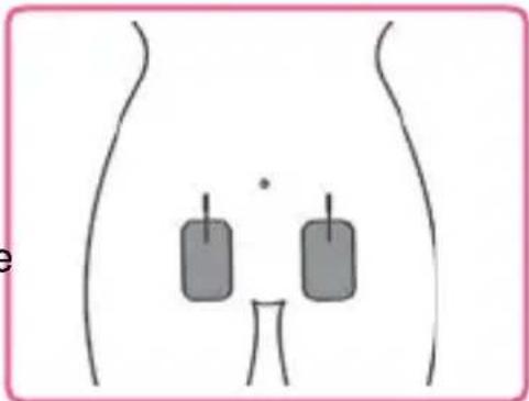 TensCare Ova - On the lower back: - 3