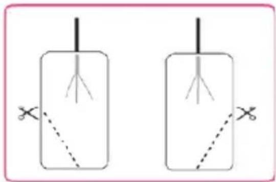 TensCare Ova - Points to note when applying the pads: - 1