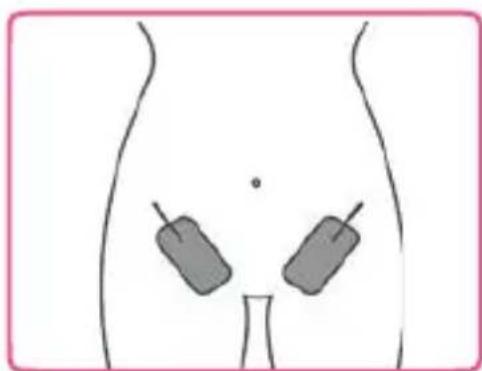 TensCare Ova - En el anverso, en formato diagonal: - 1