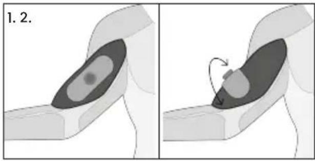 TensCare Form - Avvertenze sugli elettrodi - 2