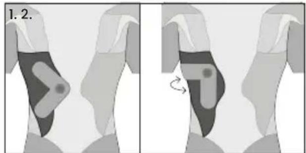 TensCare Form - Triceps - 7
