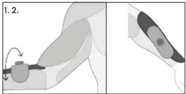 TensCare Form - Avvertenze sugli elettrodi - 1