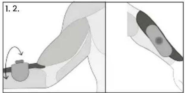 TensCare Form - Dépannage - 2