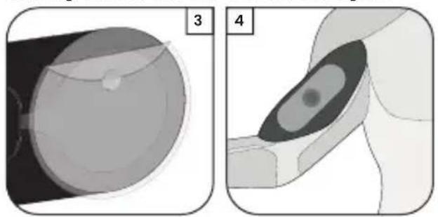 TensCare Form - Vorbereitungen für eine Sitzung - 2