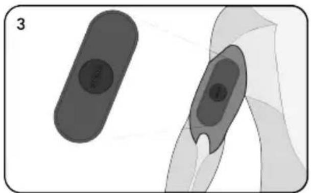 TensCare Form - Quickstart Guide - 3