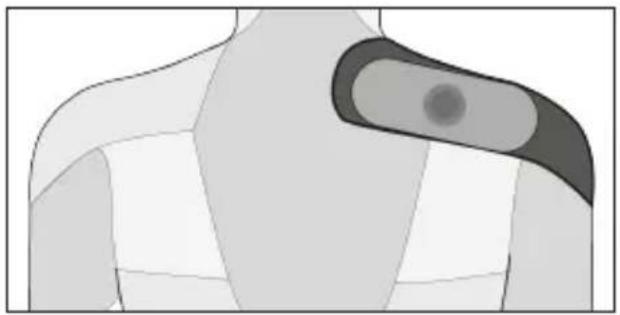 TensCare Form - Tríceps - 4