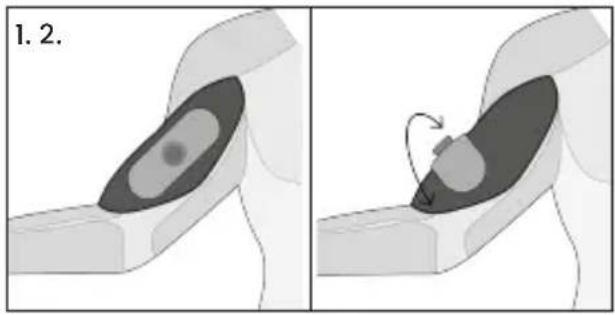 TensCare Form - Bíceps - 1