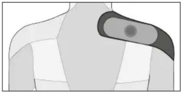 TensCare Form - Triceps - 4